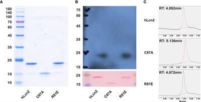 Lipocalin-2 Variants and Their Relationship With Cardio-Renal Risk Factors